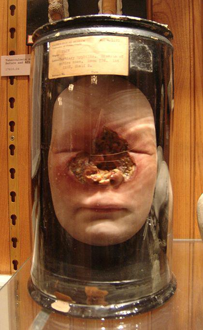 Mutter Museum of the History of Medicine (14 photos). Page 1
