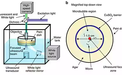 Нейробиологи научились управлять нейронами при помощи ультразвука