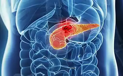 Гастроэнтерологи пришли к выводу, который может спасти от смертельного недуга миллионы людей.