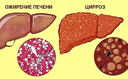 Эта хитрость защищает печень от разрушения! Нужно пить…