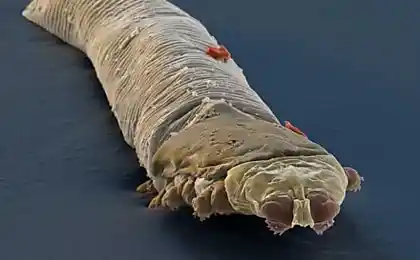 10 of the most disgusting things in our body