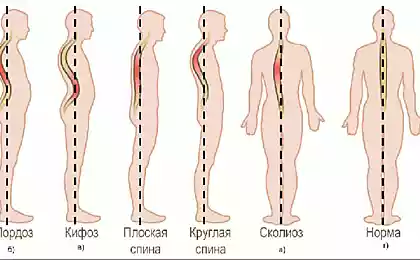 Экспресс-комплекс упражнений для осанки