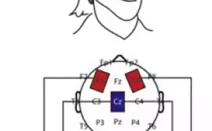 Учёные улучшили творческие способности людей при помощи электрического воздействия на мозг
