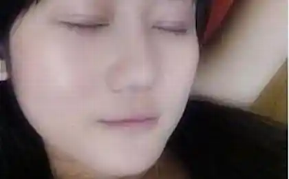 照片手术前后
