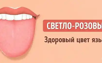 12 los problemas de los que puede decir el color de la lengua