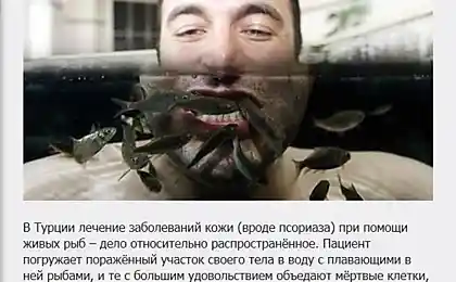 Самые необычные мотоды лечения