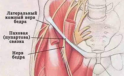 Упражнения при неврите наружного кожного нерва бедра