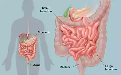 Нездоровый кишечник — главная причина аутоиммунных заболеваний