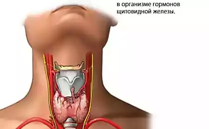 Гипотиреоз: продукты питания, ускоряющие метаболизм