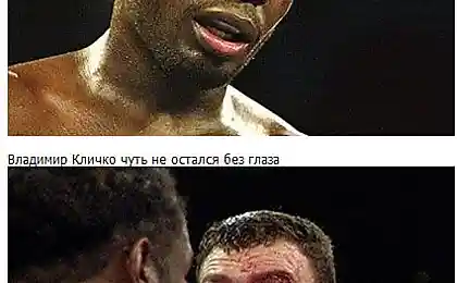 Бокс - это опасное занятие (9 фото)