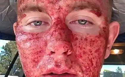 Пілінг обличчя