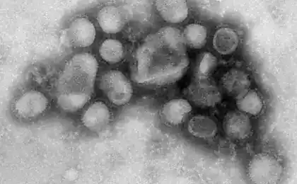 4 doloroso hecho acerca de las últimas epidemias peligrosas han surgido en el siglo 21