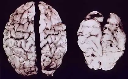 El académico de las Esquinas de la verdad y la mentira sobre las drogas permitidas