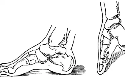 La tradición de la aristocracia: cinta médica de los pies en china