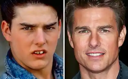 15 evidencia de que una bella sonrisa lo cambia todo