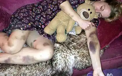 Після того, як жінка знеболюється. Що змінив своє тіло так багато хто тероризм!